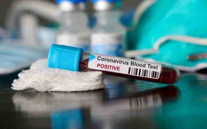 Coronavirus – In Sicilia screening seriologico per contrastare il contagio: le categorie che ne usufruiranno